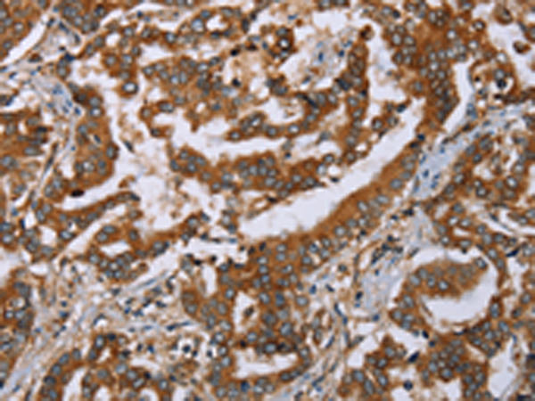 Rabbit Polyclonal Antibody to PLXNB1