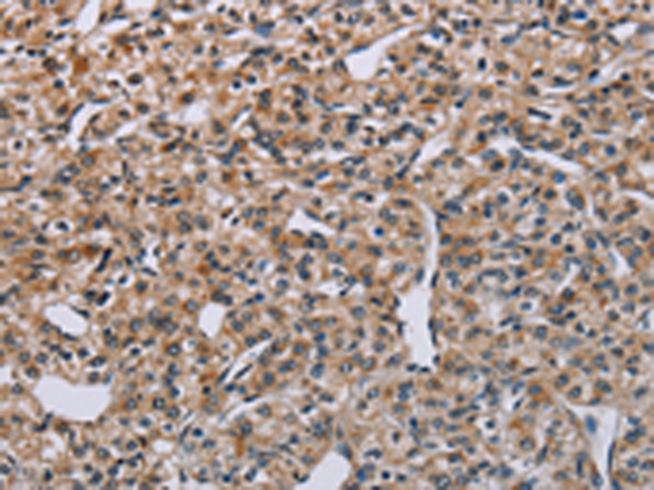 Rabbit Polyclonal Antibody to PNPT1