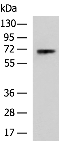 Rabbit Polyclonal Antibody to POU6F2