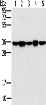Rabbit Polyclonal Antibody to PPP1CC