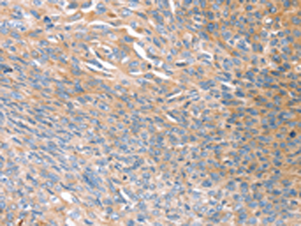 Rabbit Polyclonal Antibody to PRSS8