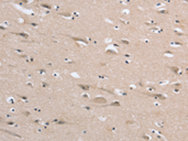 Rabbit Polyclonal Antibody to DLG2