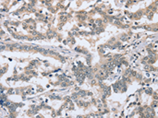 Rabbit Polyclonal Antibody to PTGER1