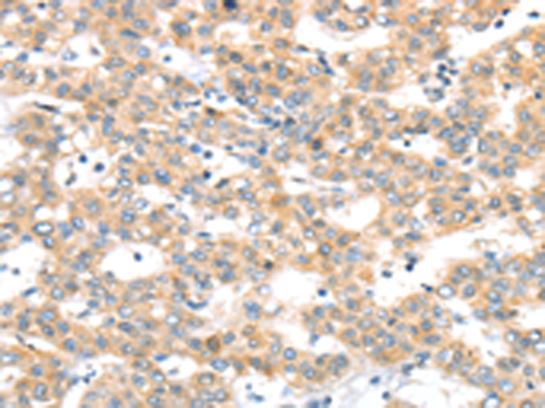 Rabbit Polyclonal Antibody to RAB24