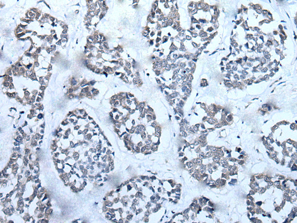Rabbit Polyclonal Antibody to RAD54B