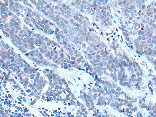 Rabbit Polyclonal Antibody to RARG