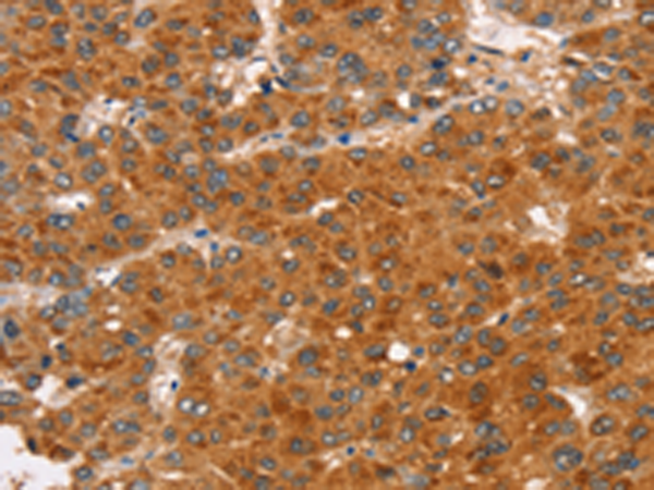 Rabbit Polyclonal Antibody to RASA3