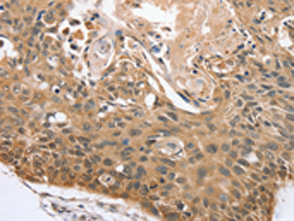 Rabbit Polyclonal Antibody to RBM38