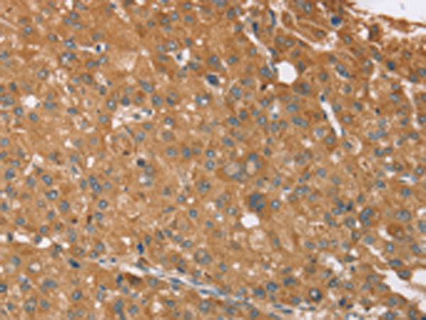 Rabbit Polyclonal Antibody to NOS2