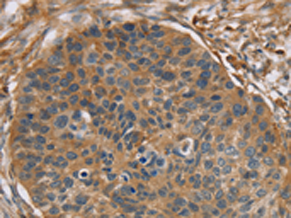 Rabbit Polyclonal Antibody to RIPK4