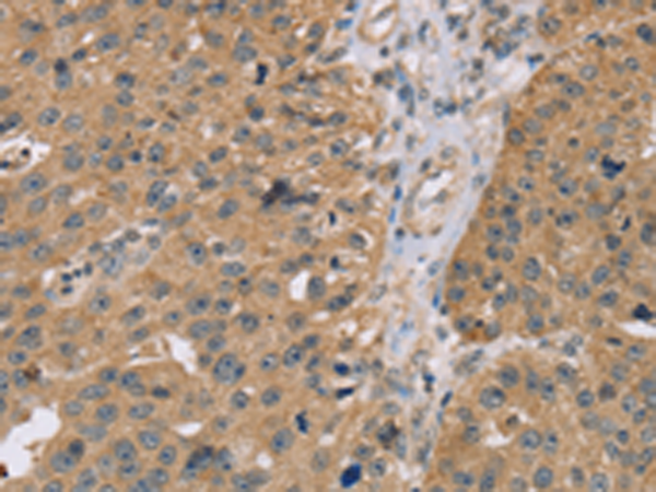 Rabbit Polyclonal Antibody to RNF139