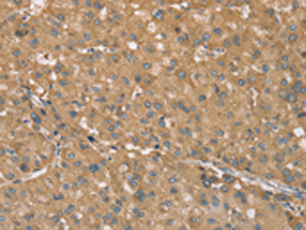 Rabbit Polyclonal Antibody to RNF148