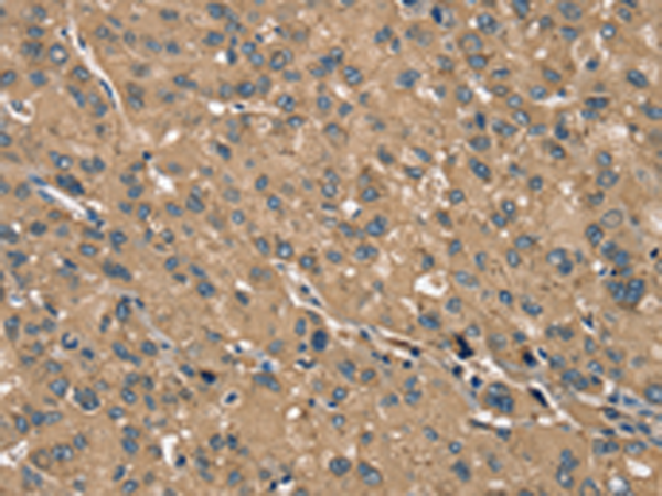 Rabbit Polyclonal Antibody to TRIM3