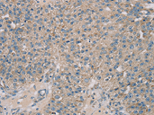 Rabbit Polyclonal Antibody to ROBO2