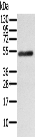 Rabbit Polyclonal Antibody to RORB