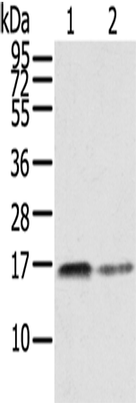 Rabbit Polyclonal Antibody to RRAS