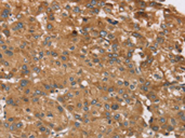 Rabbit Polyclonal Antibody to RPS6KA2