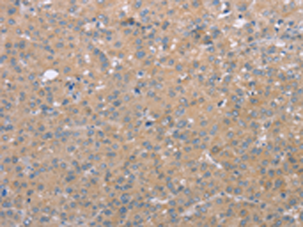 Rabbit Polyclonal Antibody to ADGRE5