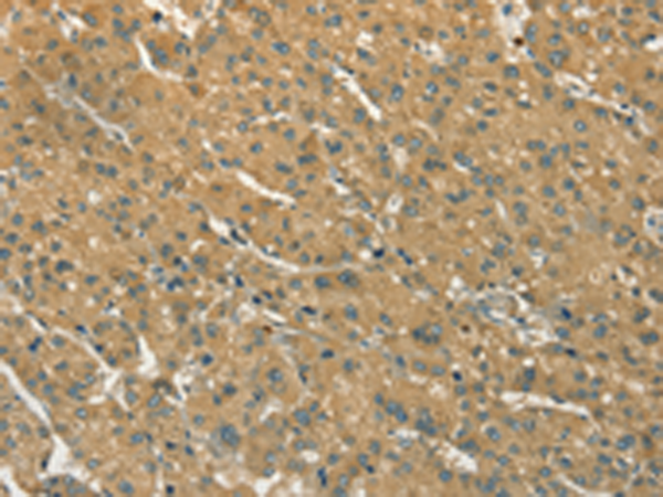 Rabbit Polyclonal Antibody to S100A6