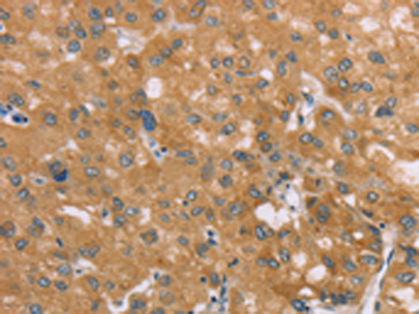 Rabbit Polyclonal Antibody to SAMD4A