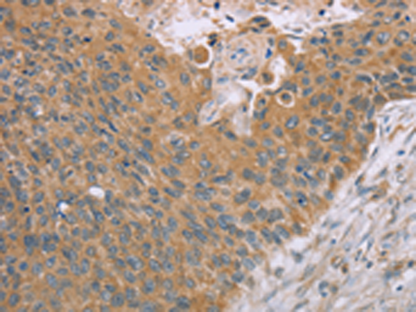 Rabbit Polyclonal Antibody to SAMD4B