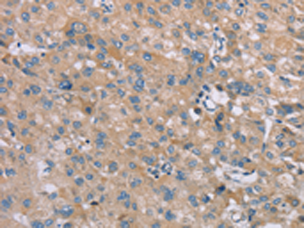 Rabbit Polyclonal Antibody to SAMD9