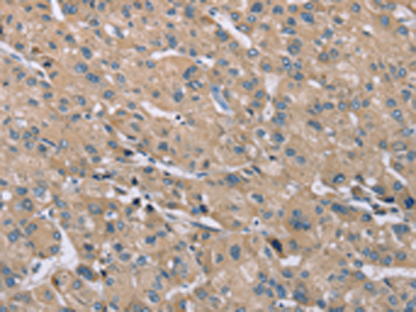 Rabbit Polyclonal Antibody to SAMD9L