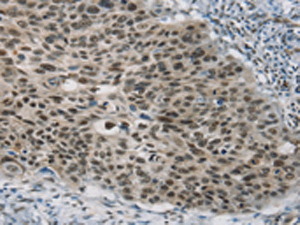 Rabbit Polyclonal Antibody to SART3