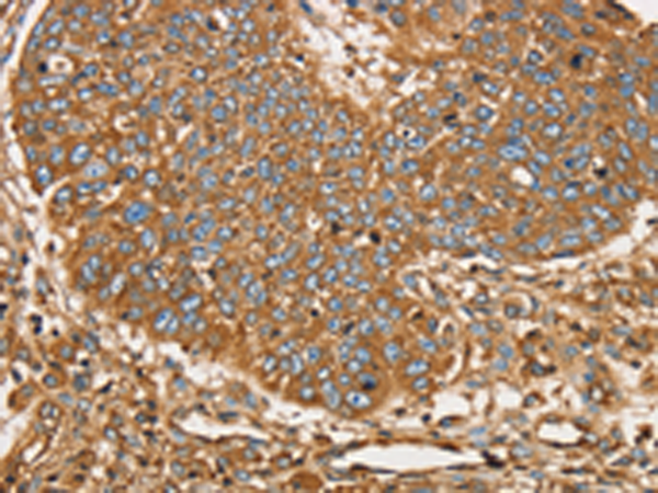 Rabbit Polyclonal Antibody to SCD
