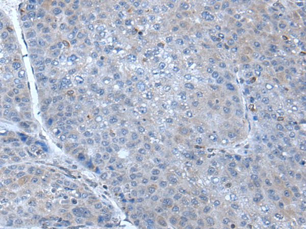 Rabbit Polyclonal Antibody to SCGB3A1