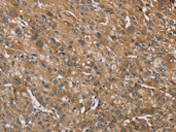 Rabbit Polyclonal Antibody to IQCJ