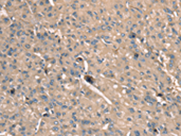 Rabbit Polyclonal Antibody to SCN1B