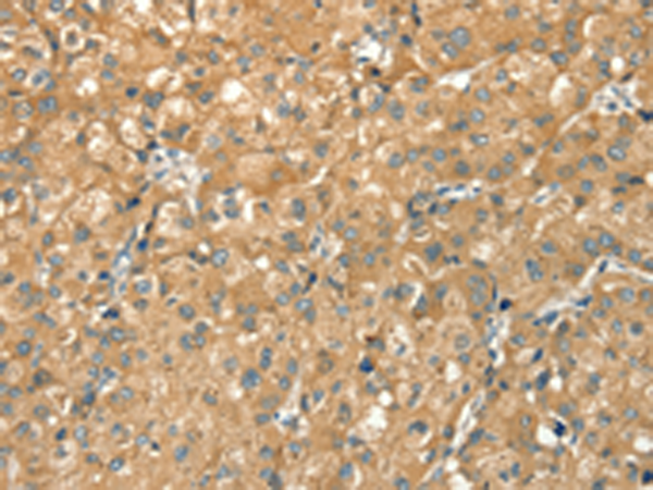 Rabbit Polyclonal Antibody to CWC27
