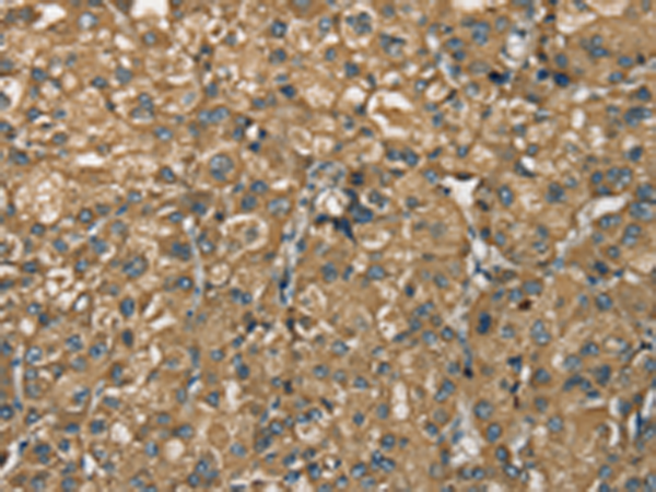 Rabbit Polyclonal Antibody to NEMF