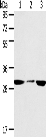 Rabbit Polyclonal Antibody to SDHB