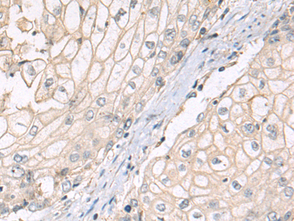 Rabbit Polyclonal Antibody to PYY