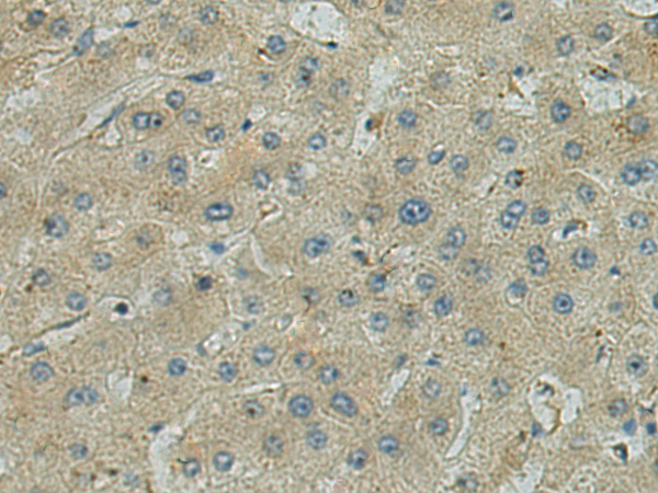 Rabbit Polyclonal Antibody to SERTAD1