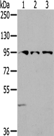 Rabbit Polyclonal Antibody to SEMA6A