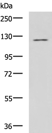 Rabbit Polyclonal Antibody to SEMA6D