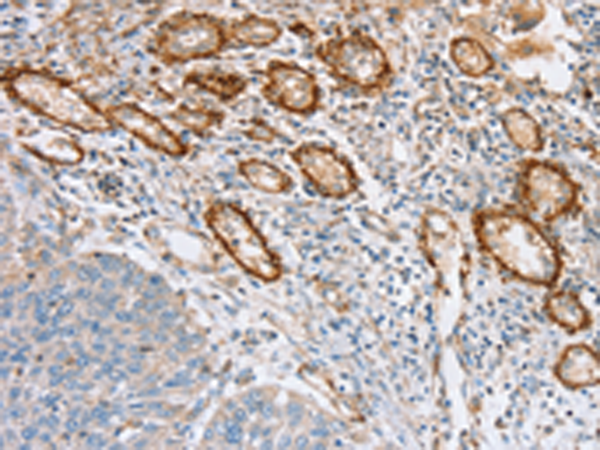 Rabbit Polyclonal Antibody to SEMA7A
