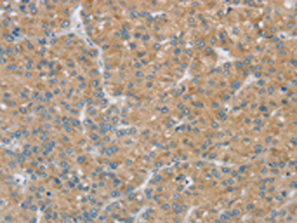Rabbit Polyclonal Antibody to SENP3