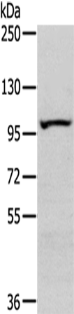 Rabbit Polyclonal Antibody to SENP6