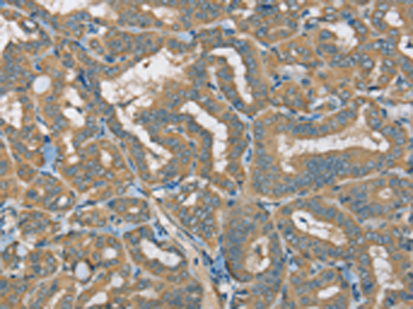 Rabbit Polyclonal Antibody to ATP2A3