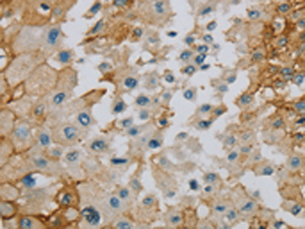 Rabbit Polyclonal Antibody to SERINC1