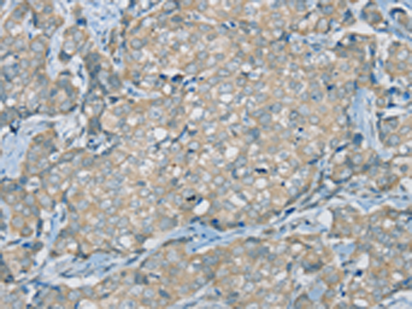 Rabbit Polyclonal Antibody to SERPINA11
