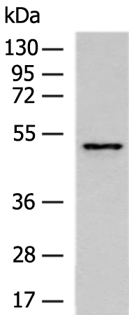Rabbit Polyclonal Antibody to SESN2