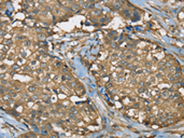 Rabbit Polyclonal Antibody to SEZ6L