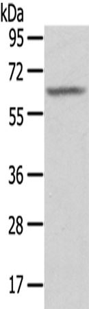 Rabbit Polyclonal Antibody to SGPL1