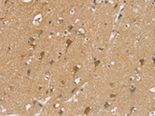 Rabbit Polyclonal Antibody to SIAH2