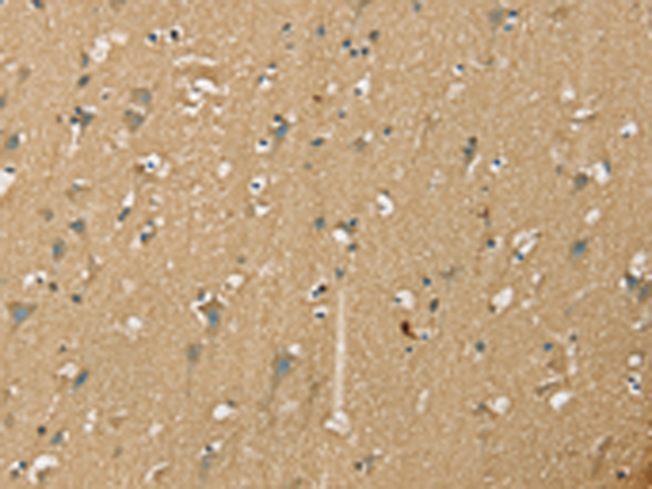 Rabbit Polyclonal Antibody to NES